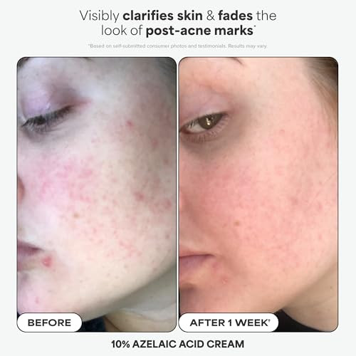 PaulaS Choice Paulas Choice Favorites Mini Kit 4 Piece Set Includes 2% Bha Exfoliant 1% Retinol Treatment 10% Azelaic Acid Booster Youth Extending Spf 50 Moisturizer Travel Skin Care Set For Glowing Skin