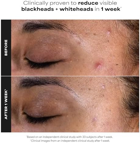 Paula's Choice SKIN PERFECTING 2% BHA Salicylic Acid Exfoliating Pads  Facial Exfoliant Pads for Blackheads Enlarged Pores Wrinkles and Fine Lines