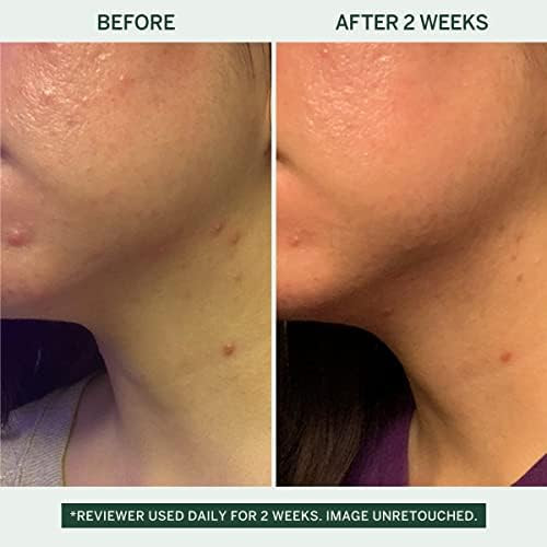 FACETORY Urban Calm Barrier Cream Hydrating Face Moisturizer with Hyaluronic Acid and Fermented Honeybush, Daily Moisturizer Face Cream for Aging Dry Skin & Sensitive Skin