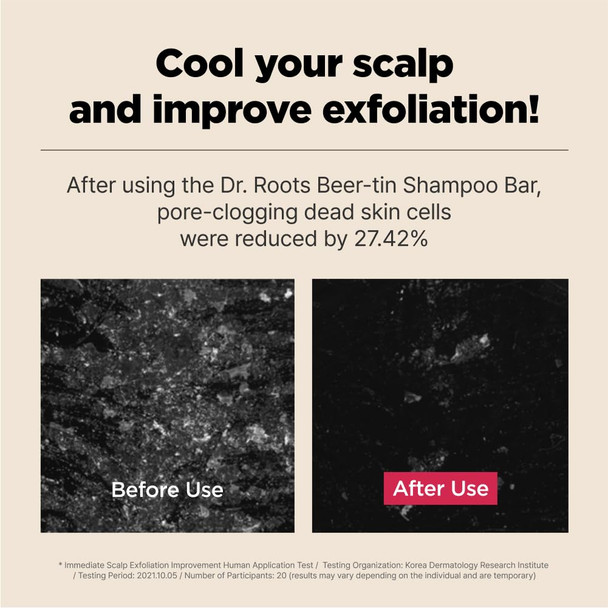 ISOI Dr. Roots Beer-Tin Solid Shampoo Bar, Nourishing & Strengthening Natural Hair Soap Bar Shampoo, with Beer Yeast & Biotin, Plastic-Free Clean Beauty, Korean Hair Care (3.52 oz, 100g) - Beer Yeast