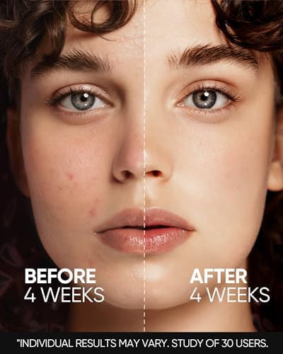 SKINTIFIC Beginner Retinol Serum with 0.1% Retinol & Zinc PCA, 20ml | Gentle, Fragrance-Free Night Serum for Oily Skin, Helps Refine the Look of Pores And Uneven Texture