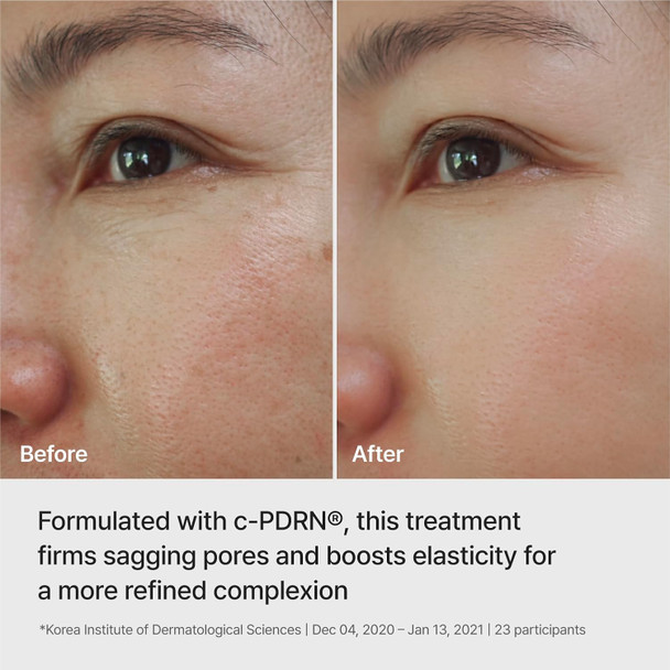 REJURAN Ampoule Infused Lifting Mask, DOT™ c-PDRN® Hydrogel, 4 Count