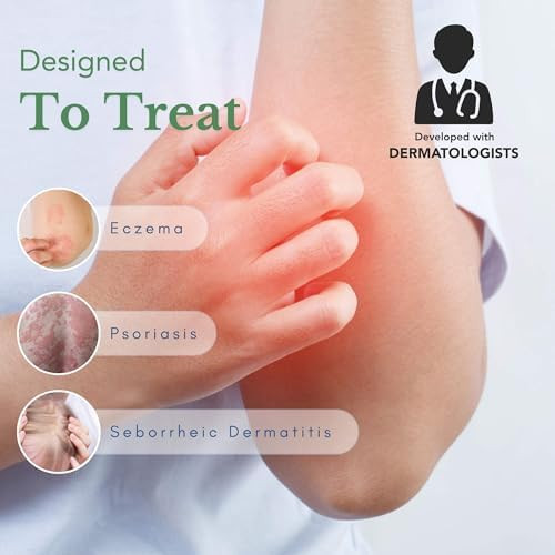 Theraplex AIM - Anti-Itch Moisturizing Cream (3 oz)  Non stinging  Relieves Itching, Rashes  Flare Ups  Helps Repair & Restore the Skin's Natural Protective Barrier