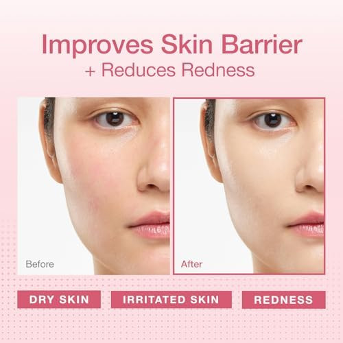 PHYSIOGEL Calming Relief Redness Relieving Facial Cream Soothing Face Moisturizer With Squalane For Dry Irritated & Redness-Prone Skin