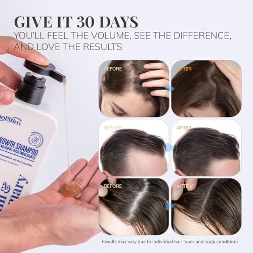 RootStim Biotin & Rosemary Hair Growth Shampoo for Thinning Hair