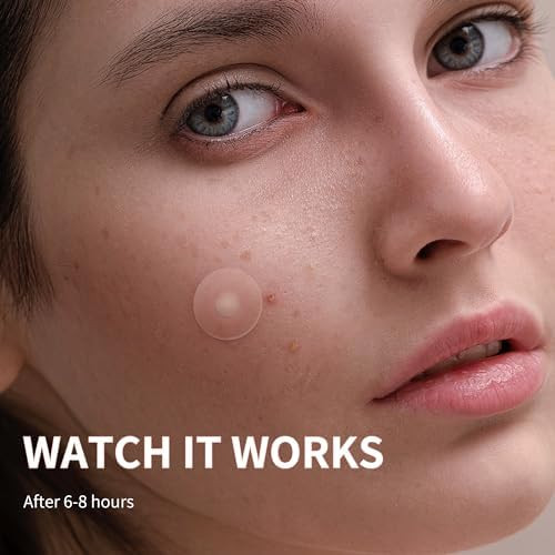 Daolyo Pimple Patches for Face Hydrocolloid Acne Patches