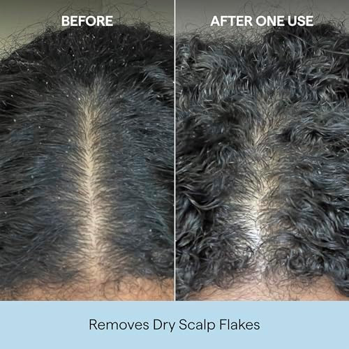 Briogeo Scalp Revival Charcoal Coconut Oil Micro Exfoliating Shampoo  Sulfate Free Scalp Scrub for Dry Itchy or Oily Scalp  Detoxifying and Hydrating  Vegan and Cruelty Free