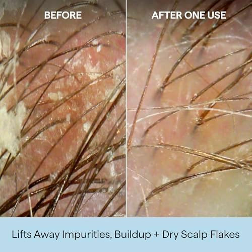 Briogeo Scalp Revival Charcoal Coconut Oil Micro Exfoliating Shampoo  Sulfate Free Scalp Scrub for Dry Itchy or Oily Scalp  Detoxifying and Hydrating  Vegan and Cruelty Free