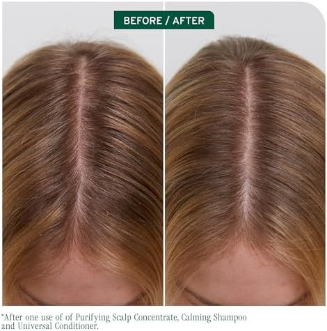 Biolage Scalp Sync Calming Shampoo – For Sensitive Scalps
