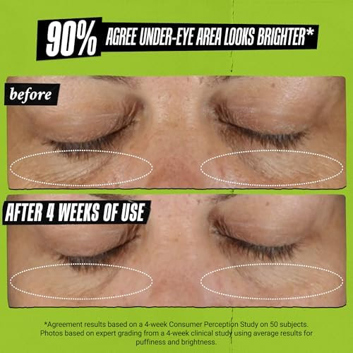 Kiehl's - Avocado Eye Treatment, for Dry Lines & Puffiness