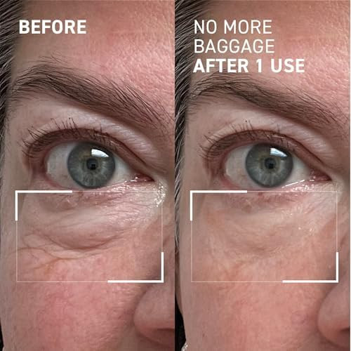 Dr. Brandt Skincare  Needles No More No More Baggage