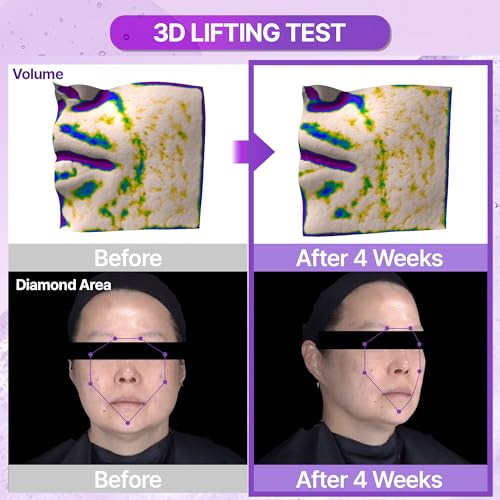 Bioheal Boh Probioderma" 3D Lifting Ampoule Advanced Elasticity Serum For Sculpted Firm Skin Powerful 3D Lifting Formula With Probiotics and Peptides For Daily Skincare 1.01 Fl Oz 30 Ml