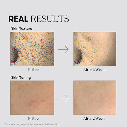 Vt Cosmetics Tx Toning Essence 1000 Shot Tranexamic Acid Serum With Niacinamide Glutathione For Radiant Skin Face Dark Spots Sun Spots Age Spots Acne Scar Korean Skin Care 1.01 Fl. Oz.