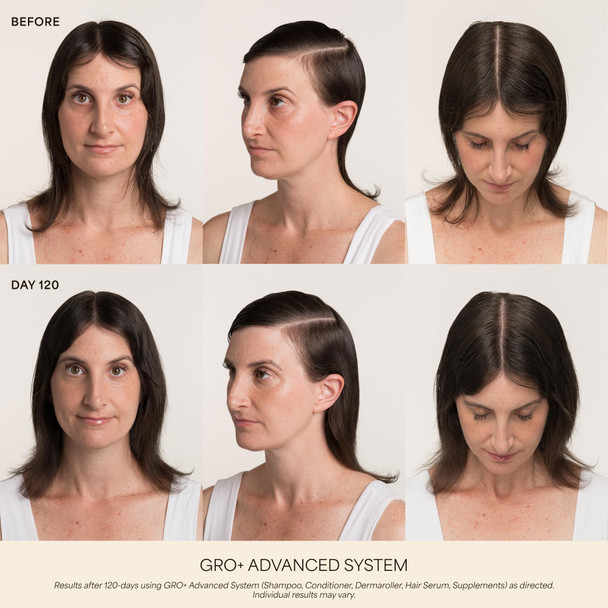 VEGAMOUR GRO+ Advanced Hair Growth and Density Supplements