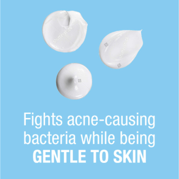 Neutrogena On-The-Spot Acne Spot Treatment with 2.5% Benzoyl Peroxide Acne Treatment Medicine to Treat Face Acne, Gentle Benzoyl Peroxide Pimple Gel for Acne Prone Skin.75 oz (Pack of 6)