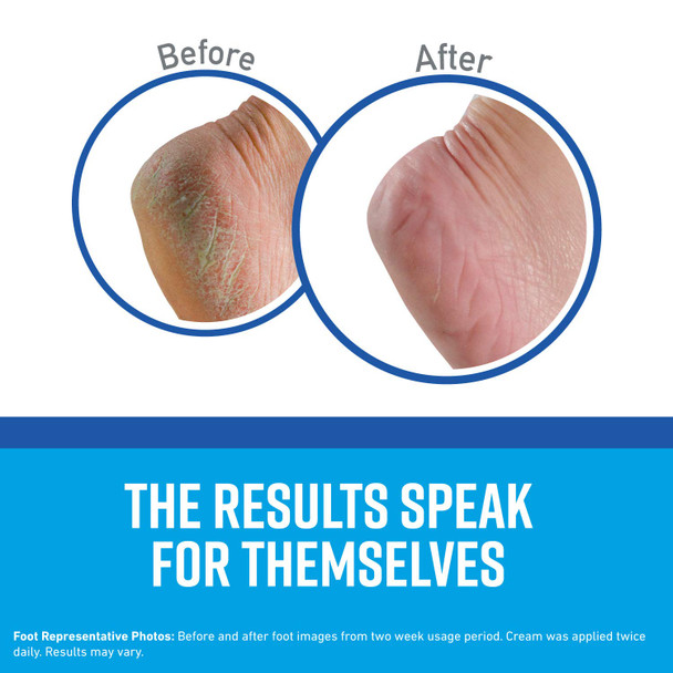 O'Keeffe's Healthy Feet Foot Cream for Extremely Dry, Cracked Feet, 3.2 Ounce Jar, (Pack of 1)