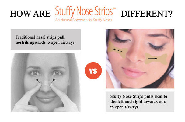 STUFFY NOSE SOLUTIONS Stuffy Nose Strips, Increases Airflow due to Allergies, Colds and Snoring | All Natural and Hypoallergenic