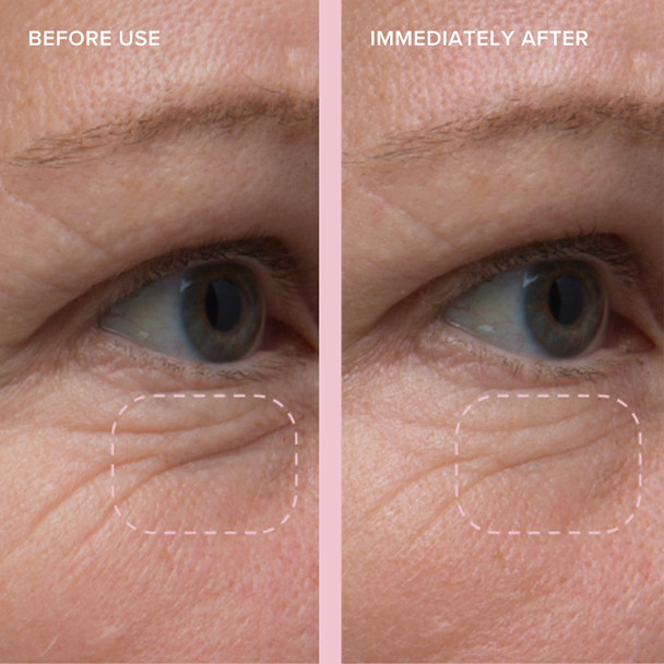 Alpyn Beauty PlantGenius Line-Filling Eye Balm with Bakuchiol0.5 oz / 15 ml