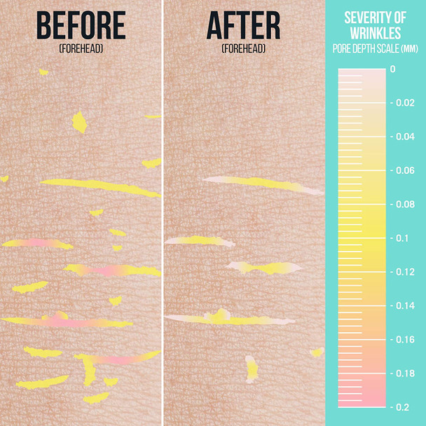 SiO Cryo System - Cold Therapy Facial Massager and Serum - Toning Tool - Reduce Fine Lines, Wrinkles, Pore Size, and Puffiness - Smooth and Tighten Skin