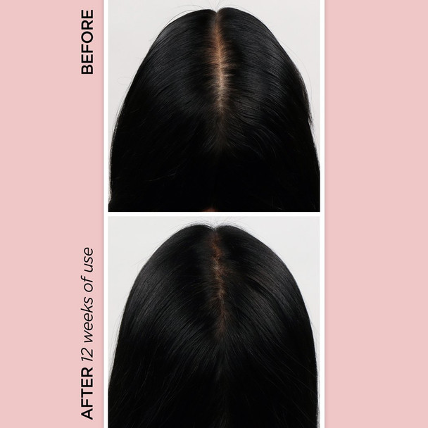BeautyBio Rejuvenating Scalp + Fuller Hair Therapy Set