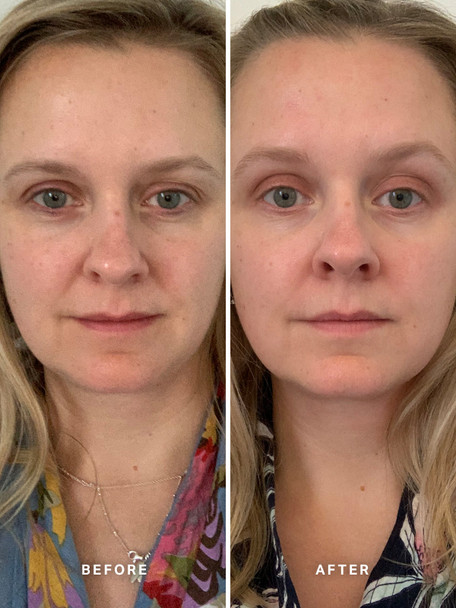 Alpha H Vitamin A Serum with 0.5% Retinol Alpha H Vitamin A Serum with 0.5% Retinol