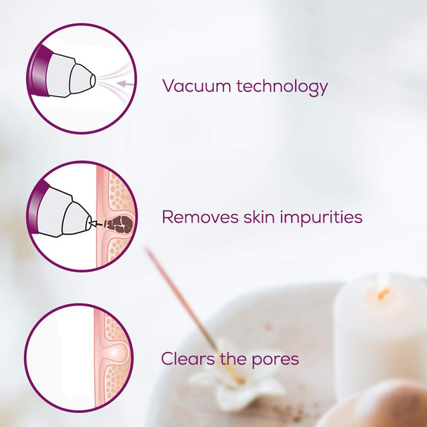 Beurer FC41 Power Deep Pore Cleanser Pore Vacuum with 5 Intensity Levels and 3 Attachments for Deep Pore Cleaning Suitable for All Skin Types