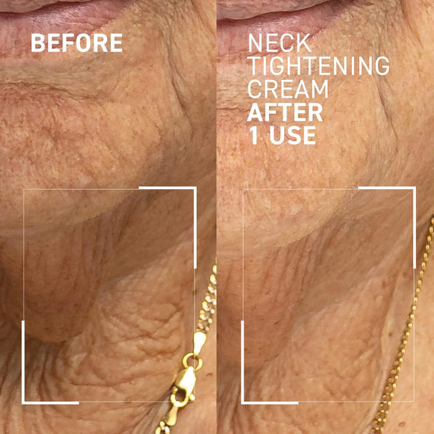 Dr. Brandt Skincare Needles No More Neck Sculpting Cream