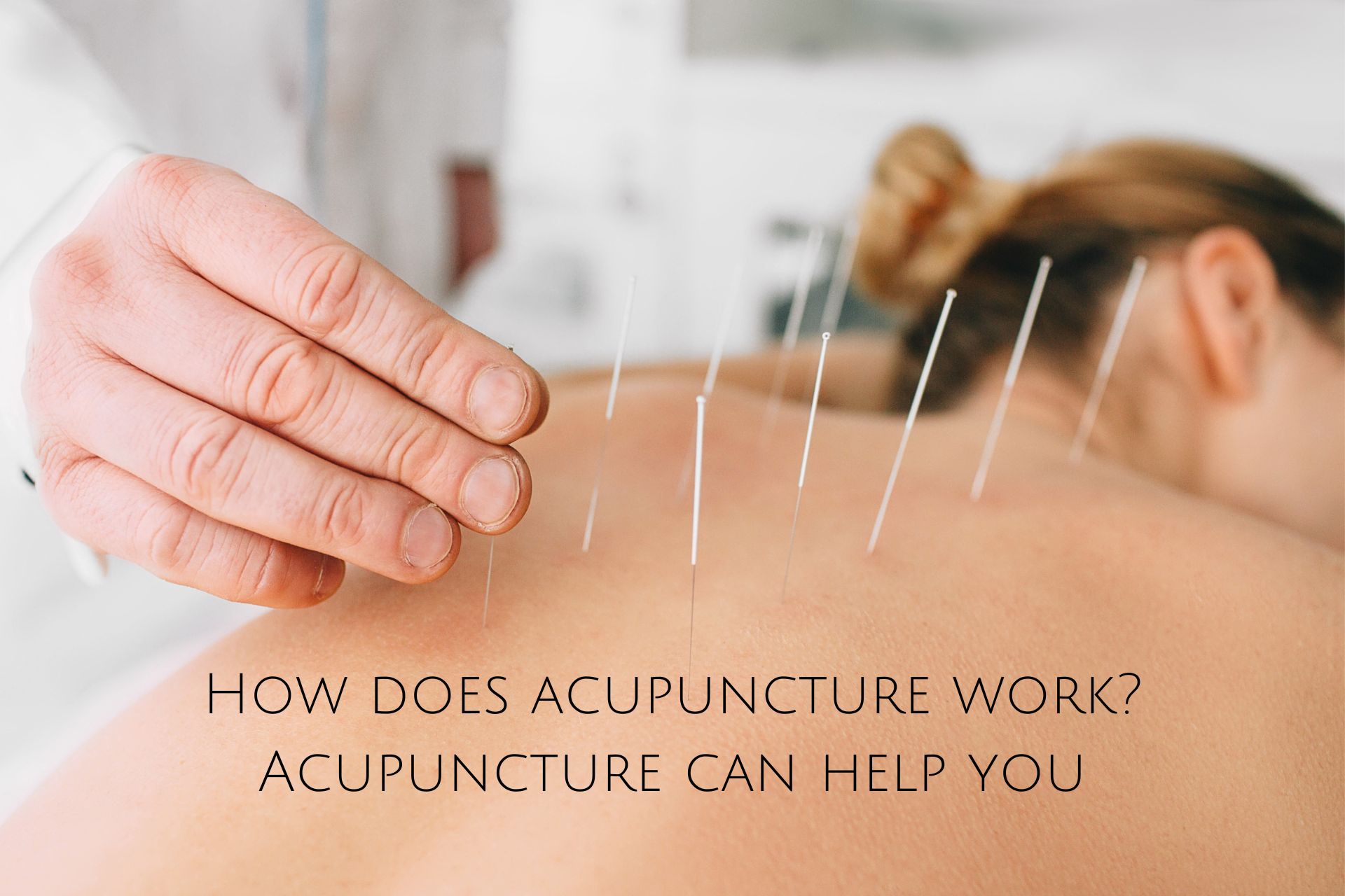 How does acupuncture work? How it helps you? Kiwla