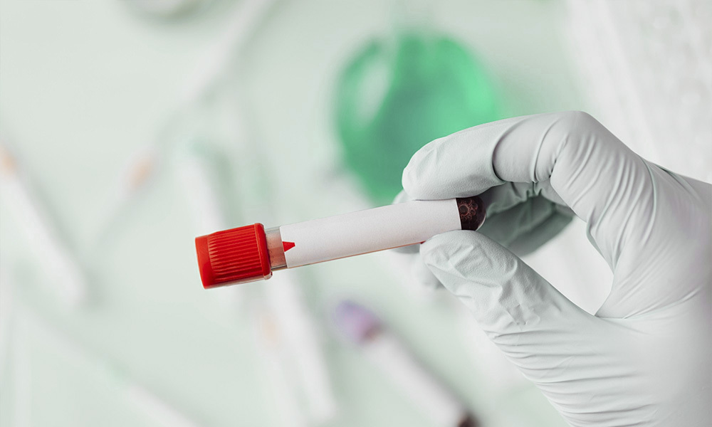 Control de parámetros clínicos en Farmacia Fornos, en Cangas, Pontevedra