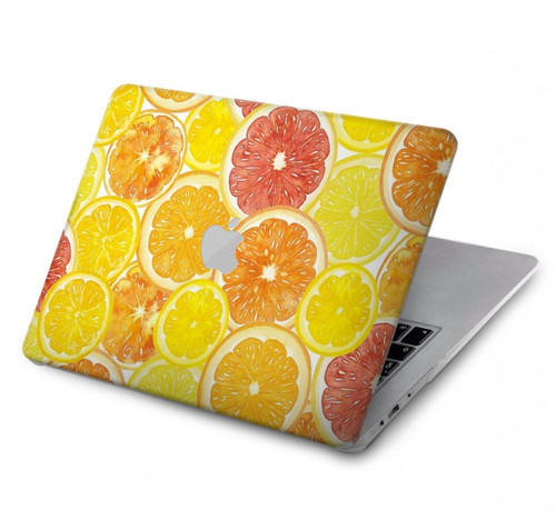 S3408 レモン Lemon MacBook Air 13″ - A1369, A1466 ケース・カバー