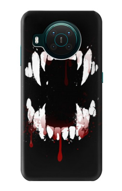 S3527 吸血鬼の歯 Vampire Teeth Bloodstain Nokia X10 バックケース、フリップケース・カバー