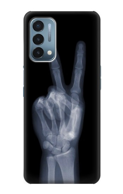 S3101 X線平和サイン手指 X-ray Peace Sign Fingers OnePlus Nord N200 5G バックケース、フリップケース・カバー