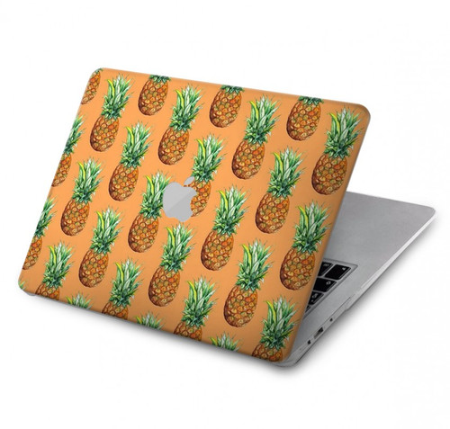 S3258 パイナップル柄 Pineapple Pattern MacBook Pro 16 M1,M2 (2021,2023) - A2485, A2780 ケース・カバー