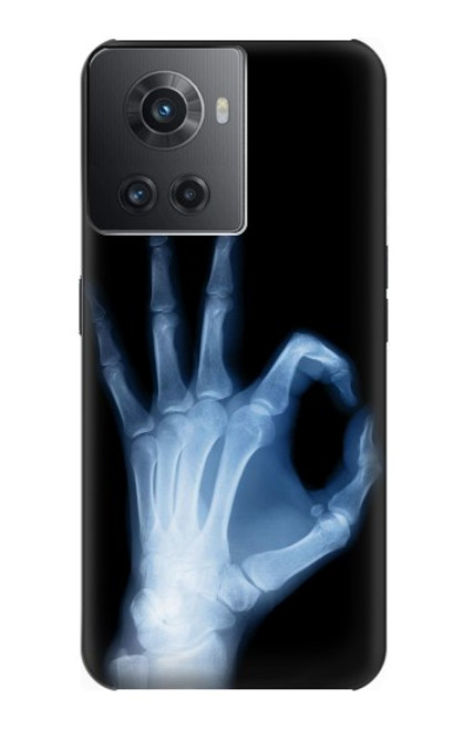 S3239 X線手札OK X-Ray Hand Sign OK OnePlus 10R バックケース、フリップケース・カバー