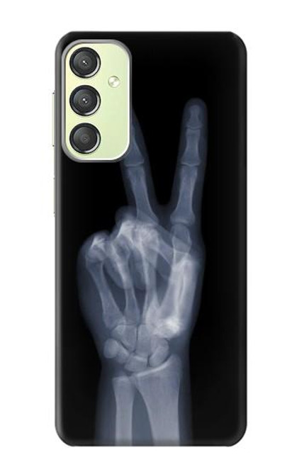 S3101 X線平和サイン手指 X-ray Peace Sign Fingers Samsung Galaxy A24 4G バックケース、フリップケース・カバー