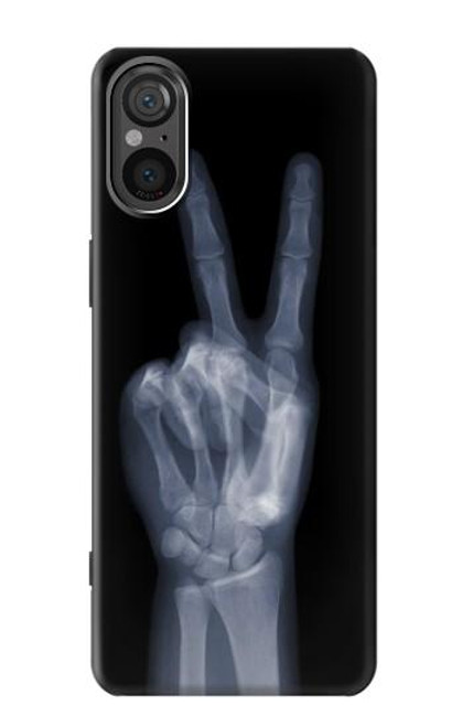 S3101 X線平和サイン手指 X-ray Peace Sign Fingers Sony Xperia 5 V バックケース、フリップケース・カバー