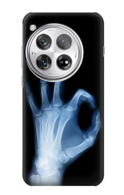 S3239 X線手札OK X-Ray Hand Sign OK OnePlus 12 バックケース、フリップケース・カバー