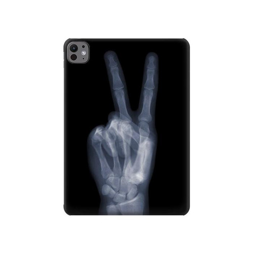 S3101 X線平和サイン手指 X-ray Peace Sign Fingers iPad Pro 11 (2024,2025) タブレットケース