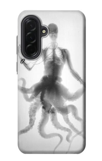 S1432 頭蓋骨のタコのX線 Skull Octopus X-ray Samsung Galaxy A36 バックケース、フリップケース・カバー