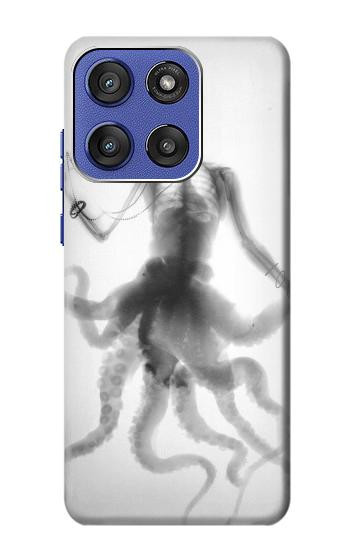 S1432 頭蓋骨のタコのX線 Skull Octopus X-ray Motorola Moto G Stylus 5G (2025,2026), Edge 60 Stylus バックケース、フリップケース・カバー