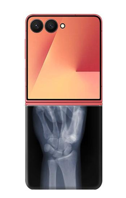 S3101 X線平和サイン手指 X-ray Peace Sign Fingers Samsung Galaxy Z Flip 7 バックケース、フリップケース・カバー