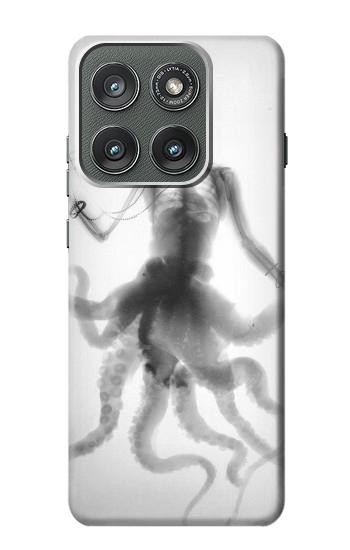 S1432 頭蓋骨のタコのX線 Skull Octopus X-ray Motorola Edge (2025) バックケース、フリップケース・カバー