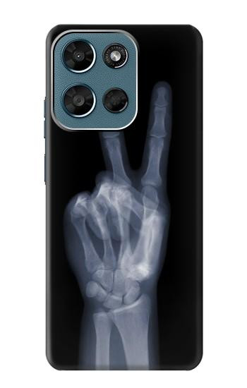 S3101 X線平和サイン手指 X-ray Peace Sign Fingers Motorola Moto G (2026), G Play (2026) バックケース、フリップケース・カバー