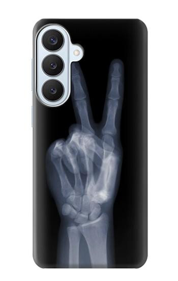 S3101 X線平和サイン手指 X-ray Peace Sign Fingers Samsung Galaxy S26 Plus バックケース、フリップケース・カバー