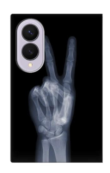S3101 X線平和サイン手指 X-ray Peace Sign Fingers Samsung Galaxy Z Fold 8 バックケース、フリップケース・カバー