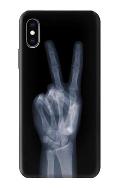 S3101 X線平和サイン手指 X-ray Peace Sign Fingers iPhone X, iPhone XS バックケース、フリップケース・カバー