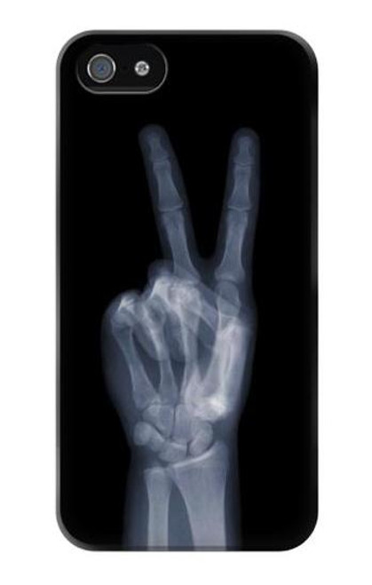 S3101 X線平和サイン手指 X-ray Peace Sign Fingers iPhone 5 5S SE バックケース、フリップケース・カバー