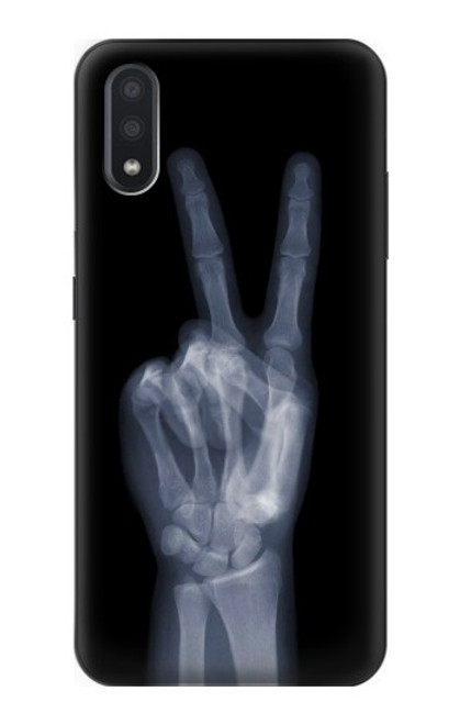 S3101 X線平和サイン手指 X-ray Peace Sign Fingers Samsung Galaxy A01 バックケース、フリップケース・カバー