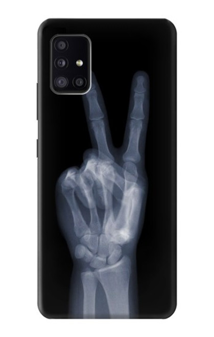 S3101 X線平和サイン手指 X-ray Peace Sign Fingers Samsung Galaxy A41 バックケース、フリップケース・カバー