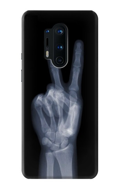 S3101 X線平和サイン手指 X-ray Peace Sign Fingers OnePlus 8 Pro バックケース、フリップケース・カバー